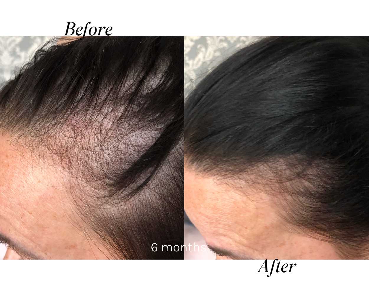 Hair Growth Results Collection