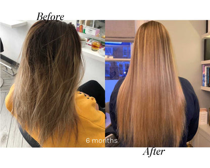 Hair Growth Results Collection