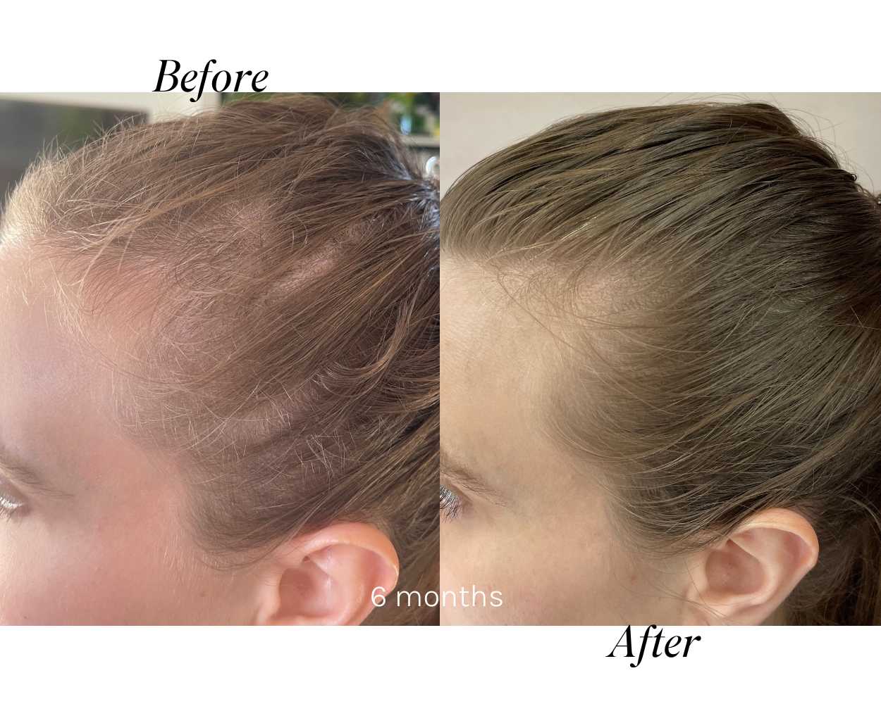 Hair Growth Results Collection